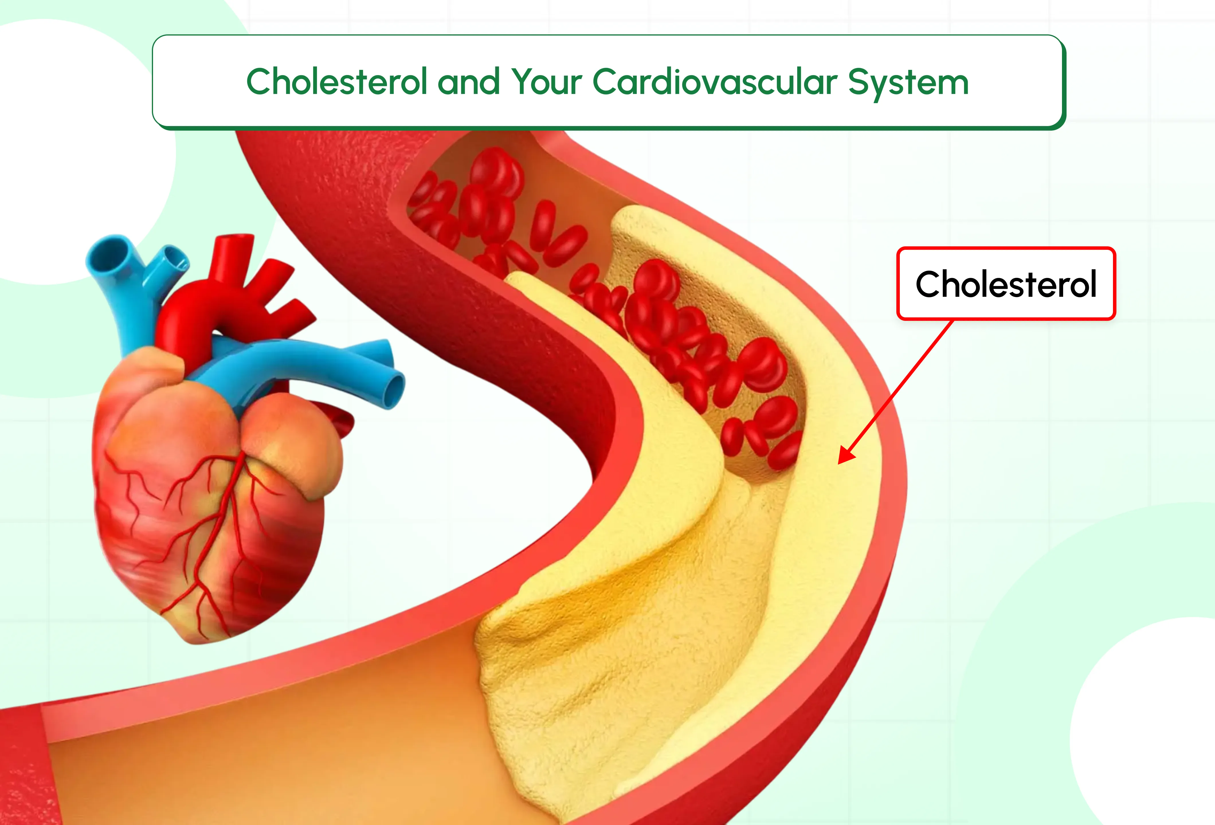 Cholesterol and Your Cardiovascular System